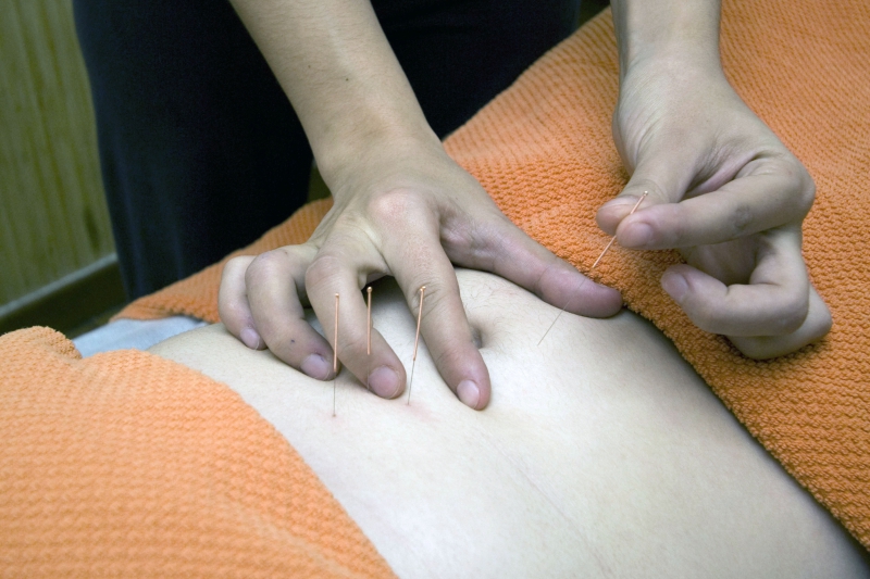 osteopathe-LA GARDE-min_acupuncture-4175625